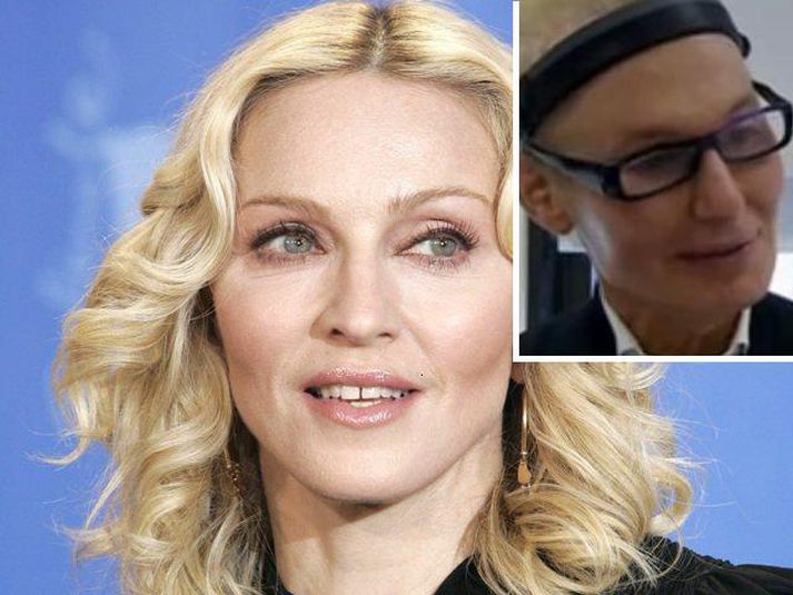 Lýtalæknir Madonnu hefur líka sett „skeljar" í andlit sitt til að hækka kinnbeinin eins og Madonna. - Frík?
