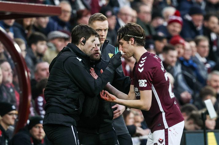 Tómas Bent Magnússon fær aðhlynningu í leiknum gegn Rangers.