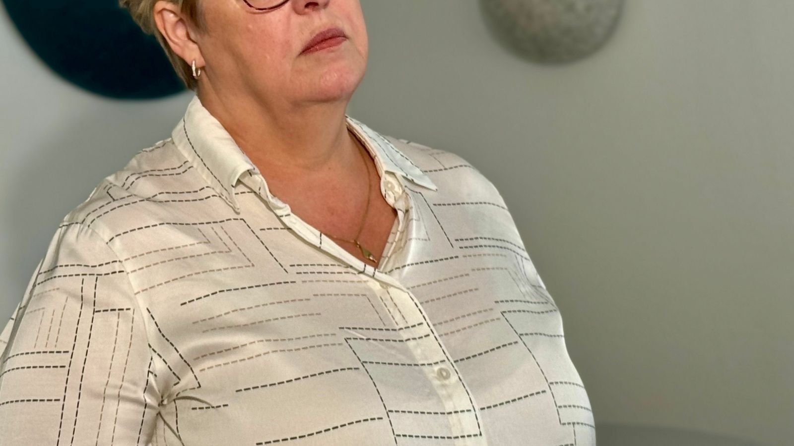 Grafalvarlegt að berklasmit hafi greinst