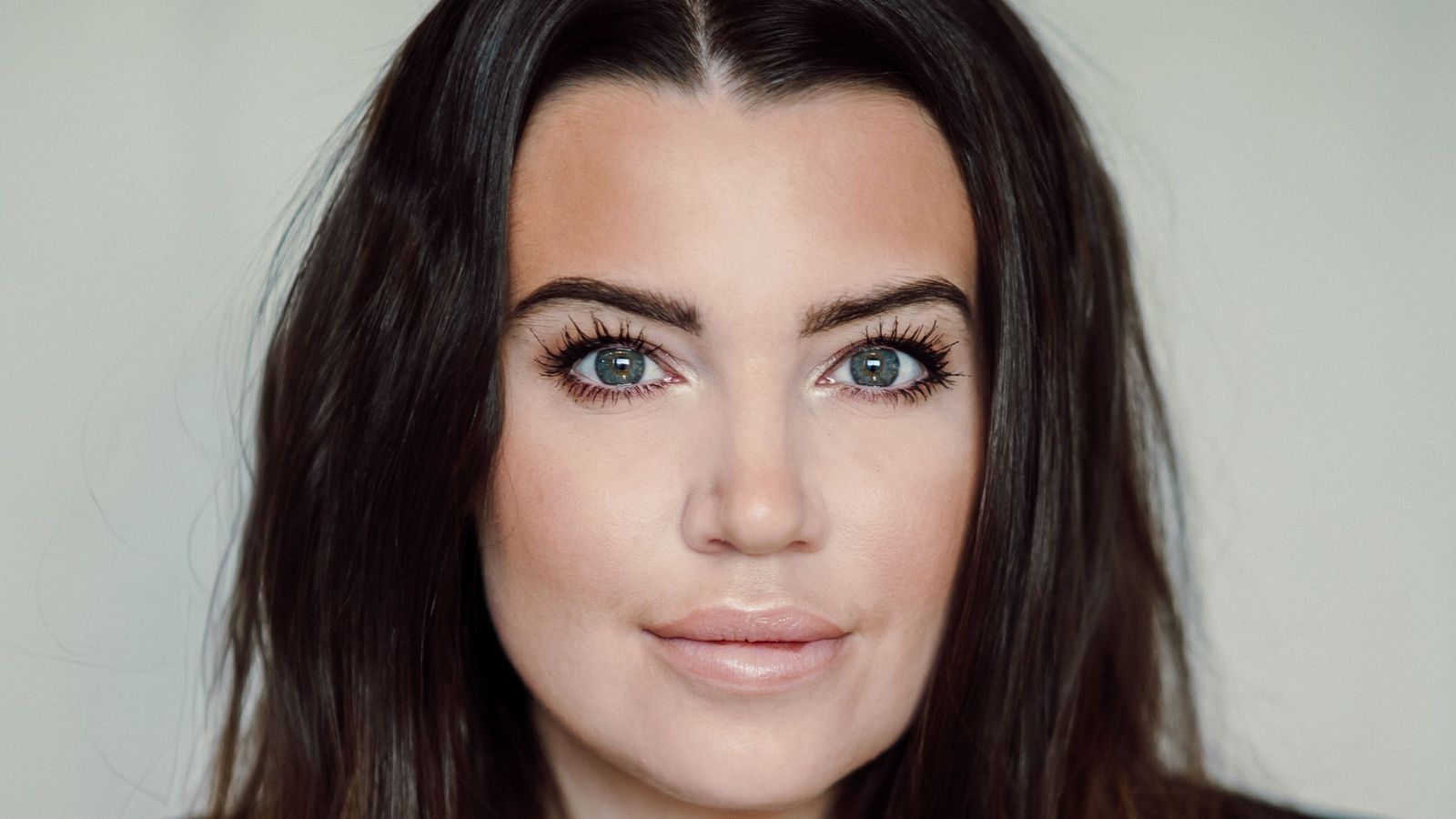 Frá læknamistökum til kerfisbaráttu - tryggingar­fé­lag vill að ríkið borgi fyrst