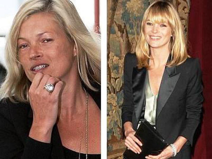 Kate Moss.
