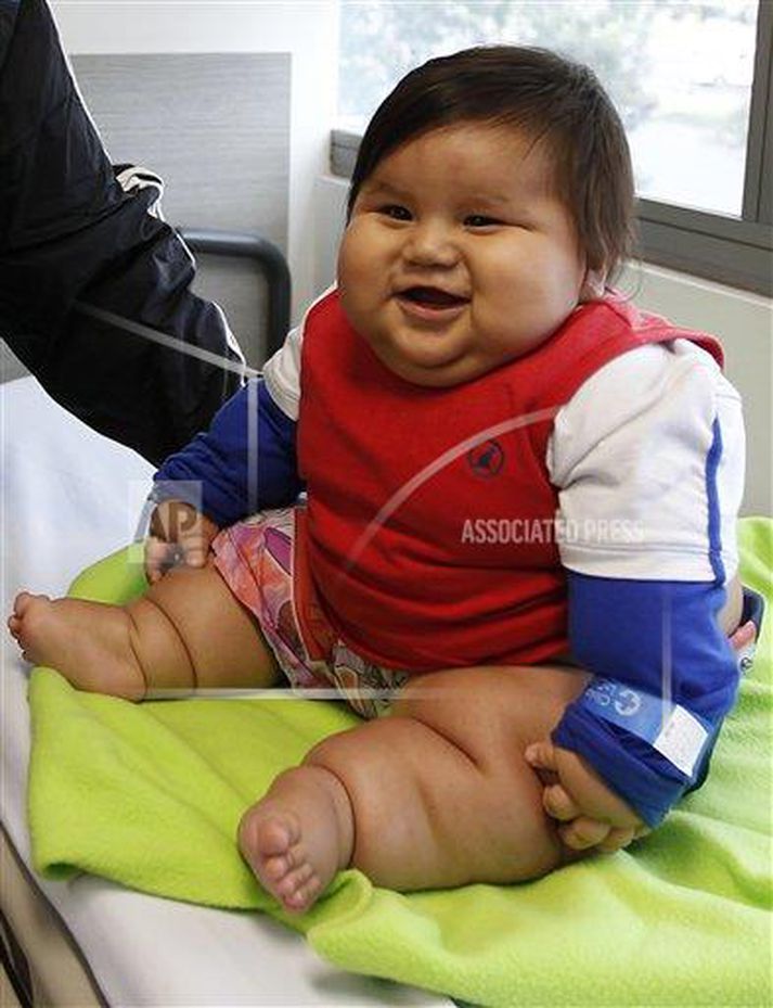 Feitasta barn Kólumbíu er komið undir læknishendur.