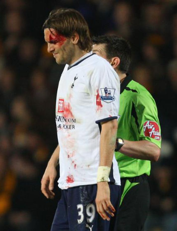 Woodgate var hetja Tottenham í kvöld. Hér yfirgefur hann völlinn blóðugur.