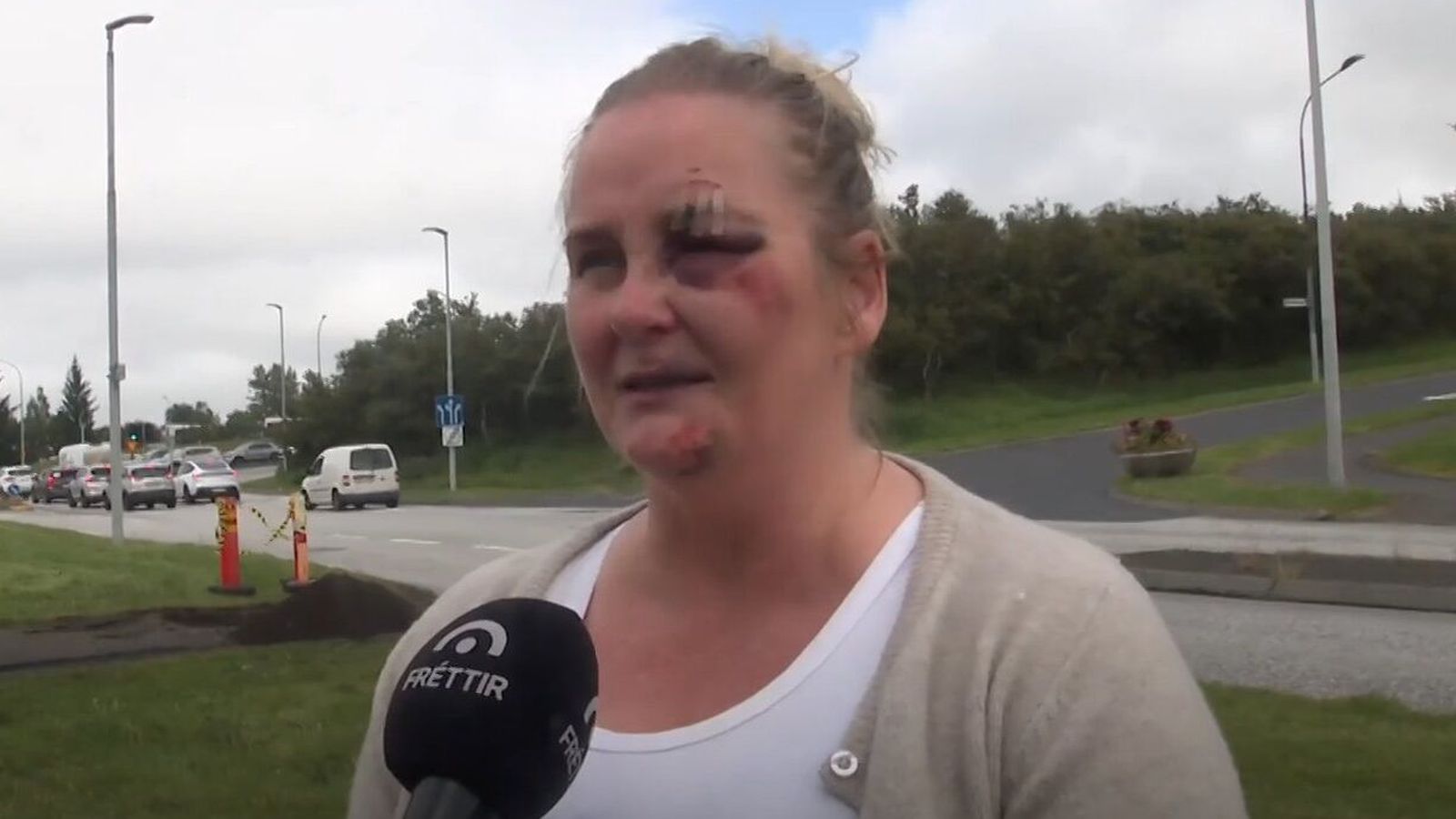 Reið en þakk­lát fyrir lífs­björgina