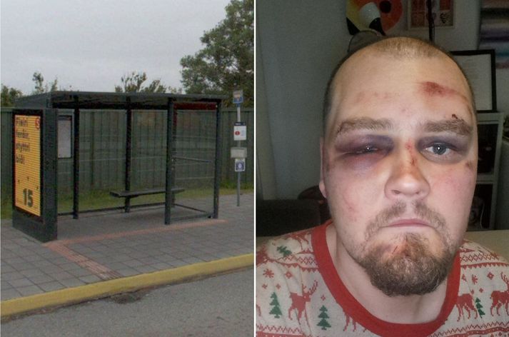 Töframaðurinn Daníel Örn Sigurðsson var í miðjum spilagaldri þegar hann var skyndilega lúbarinn við strætóskýli í Garðabæ.