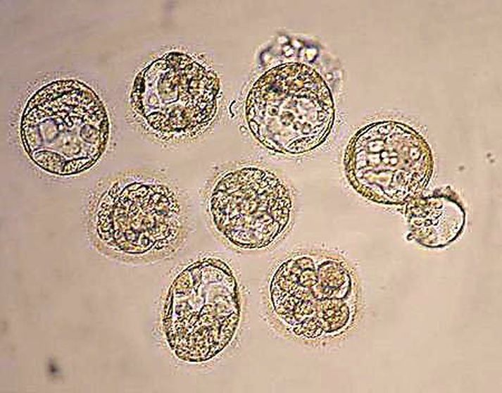 Fósturvísar. Tvíburarnir eru komnir úr einu eggi sem tvær sæðisfrumur frjóvguðu.