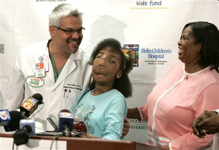 Enn sést á andliti Marliu Casseus hversu afmynduð hún hefur verið.