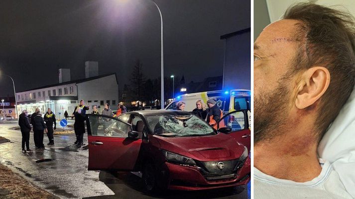 Talsverður viðbúnaður var- á Langholtsvegi þegar slysið átti sér stað og var gatan girt af að hluta.