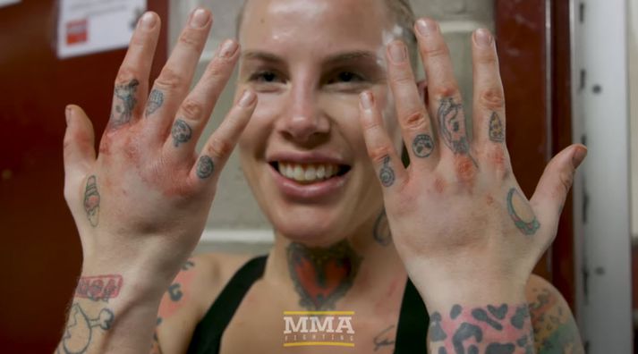 Bec Rawlings með blóðuga hnúa eftir bardagann.