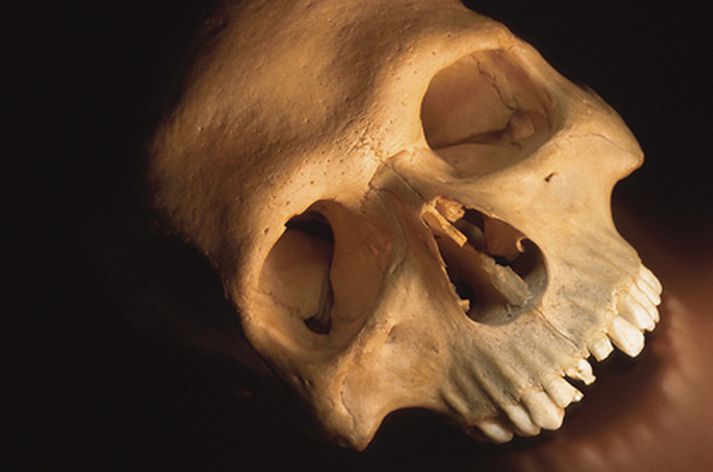 Skemmdar tennur eru bæði ljótar og sársaukafullar.