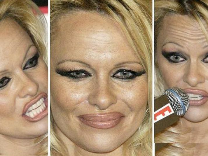 Pamela Anderson.