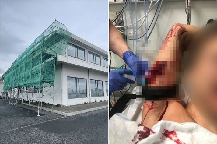 Árásin var framin í húsnæði við Vatnagarða í Reykjavík.