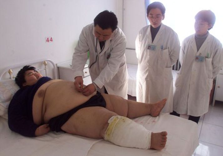 Offita getur orsakað veruleg heilsufarsvandamál.