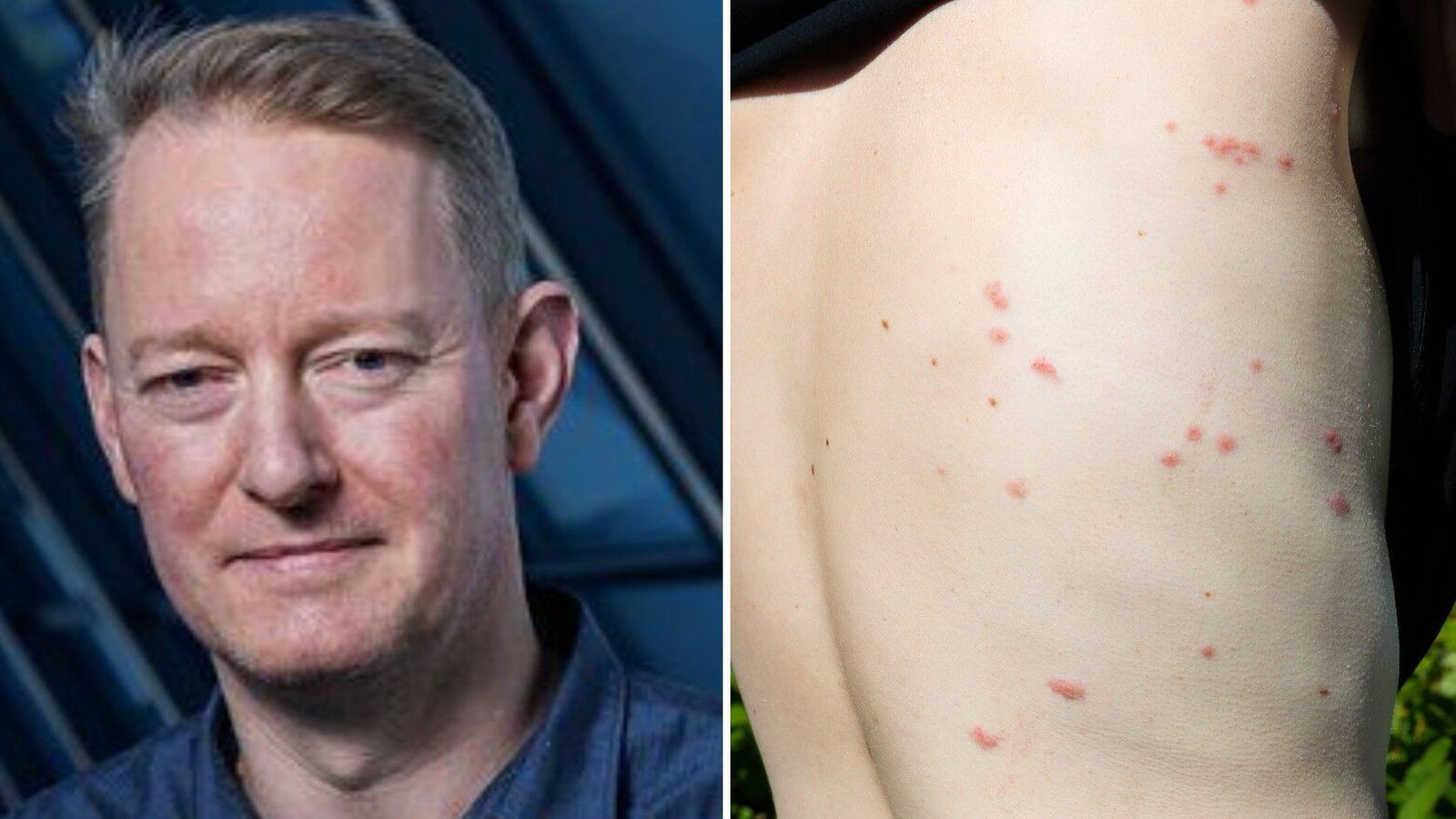 Barist gegn lúsmýinu: „Ein­hvers staðar eru þær að fjölga sér“