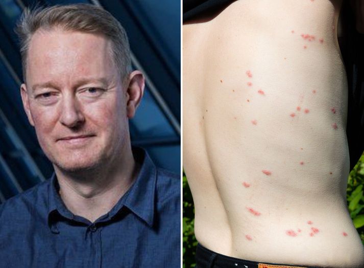 Flestir geta líklega fallist á að Arnar Pálsson, prófessor, við Háskóla Íslands hafi unnið þakklátt starf síðustu þrjú sumur. Hann hefur reynt að finna klakstöðvar lúsmýs til þess að sporna við útbreiðslu bitvargsins.