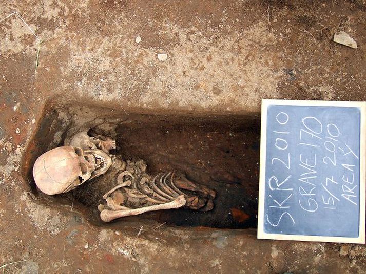 Beinagrindin sem ber einkenni Pagets-sjúkdómsins í gröf sinni á Skriðuklaustri. mynd/steinunn kristjánsdóttir