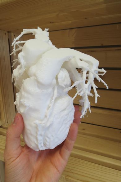 3D printed heart