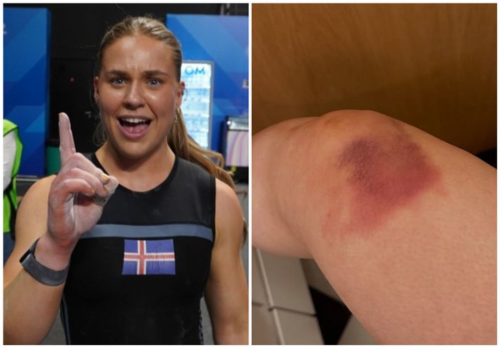 Slys á æfingu rétt fyrir EM hefði getað komið í veg fyrir EM-gullið en Eygló Fanndal Sturludóttir sýndi mikinn styrk og kláraði dæmið.