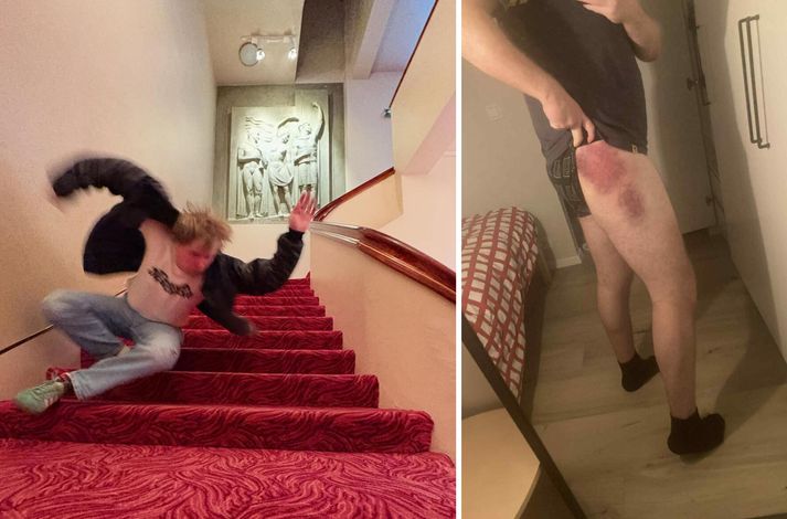 Kjartan Logi datt niður fimmtán stiga sama daginn fyrir tónlistarmyndbandið. Beint eftir tökurnar deyfði hann sársaukann með smá bjórdrykkju en morguninn eftir var hann lurkum laminn.