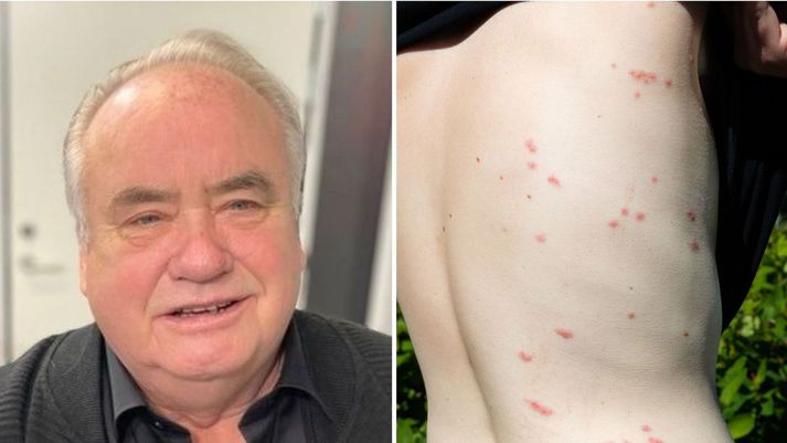 Gísli Már Gíslason er fjölfróður um hin ýmsu skordýr þó hann hafi einkum upp á síðkastið að mestu verið spurður út í lúsmý. 