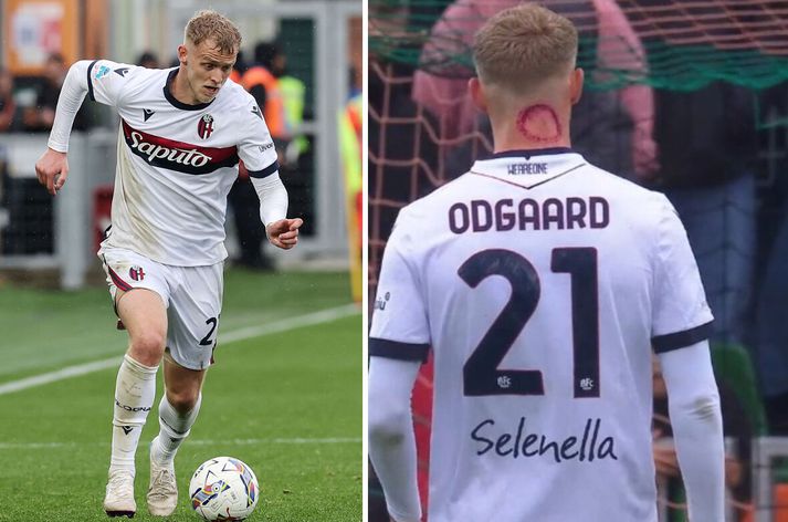 Jes Odgaard skartaði stórum rauðum hring aftan á hálsinum í leik gegn Venezia um helgina.