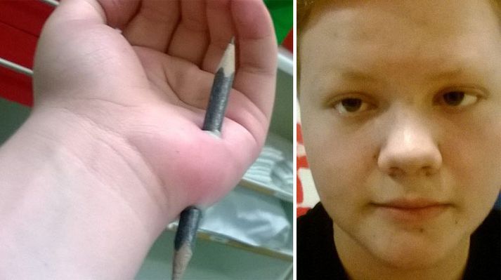 "Ég hugsa að ég kaupi mér næst blýant með strokleðri öðru megin, þá er minni hætta á að ég yddi báða enda,“ sagði Rökkvi.