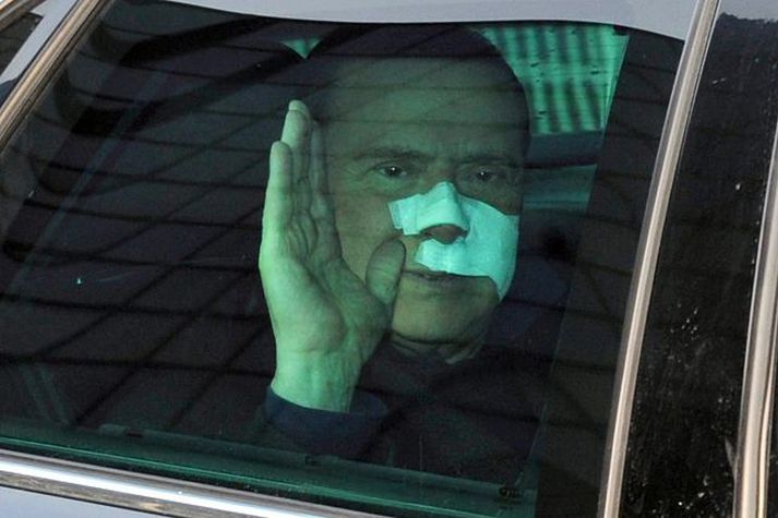 Silvio Berlusconi Forsætisráðherrann útskrifaður af sjúkrahúsi.Nordicphotos/AFP