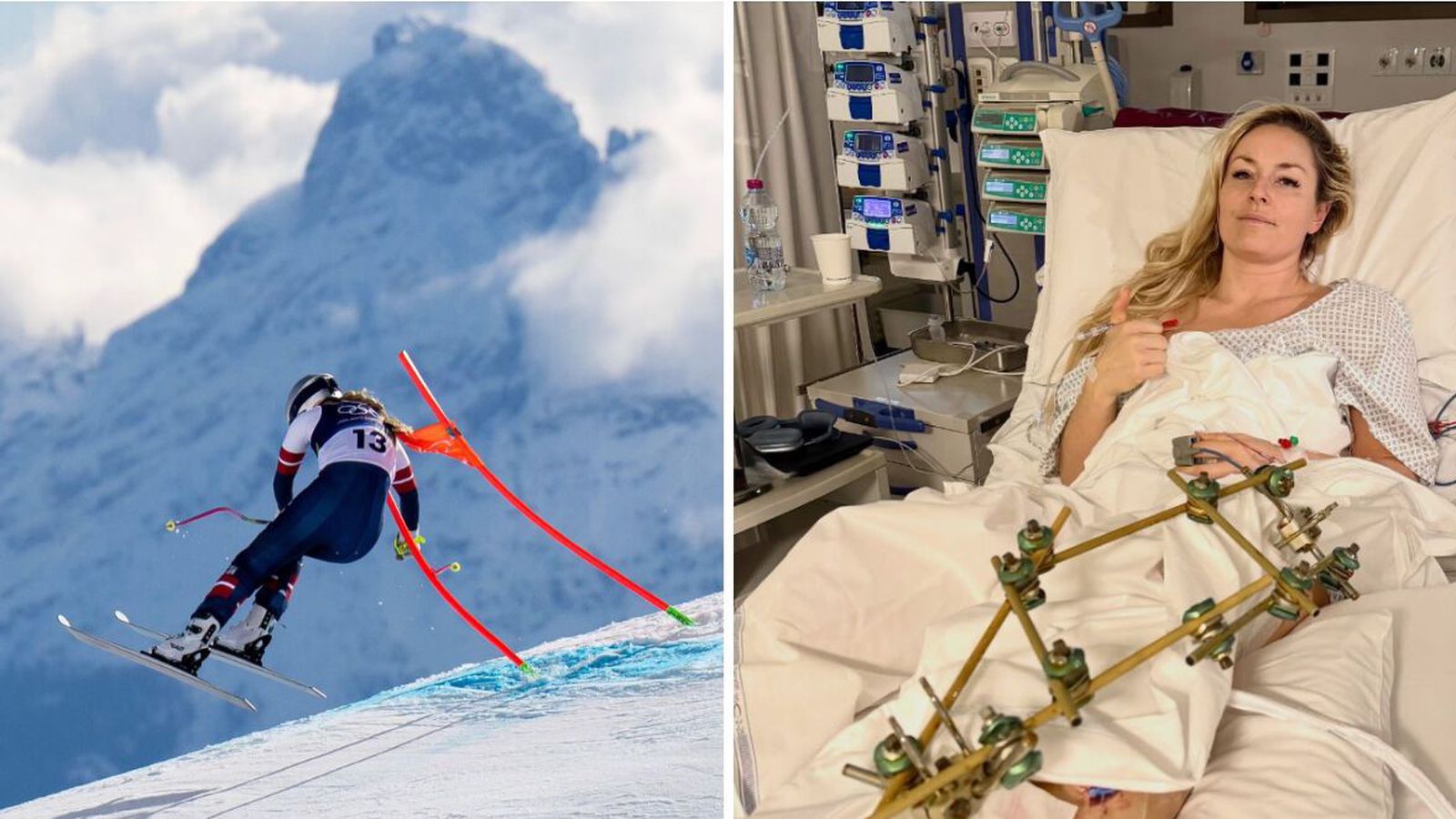 Vonn á bata­vegi eftir þriðju að­gerðina