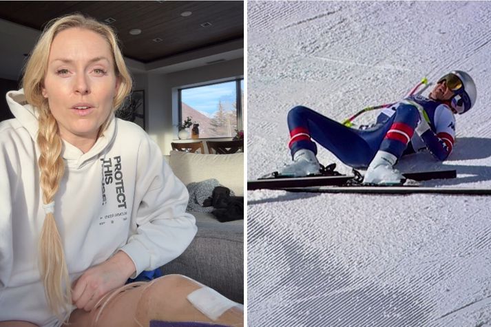 Lindsey Vonn var í hættu á að missa löppina.