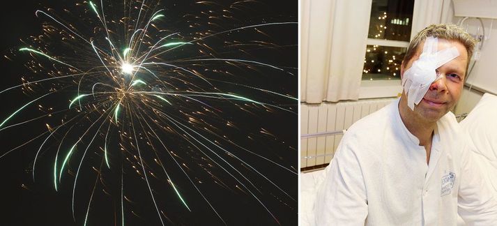 Baldur slasaðist illa á gamlárskvöld 2012 er hann fékk skoteld í höfuðið við að sprengja flugeldatertu frá Landsbjörg.