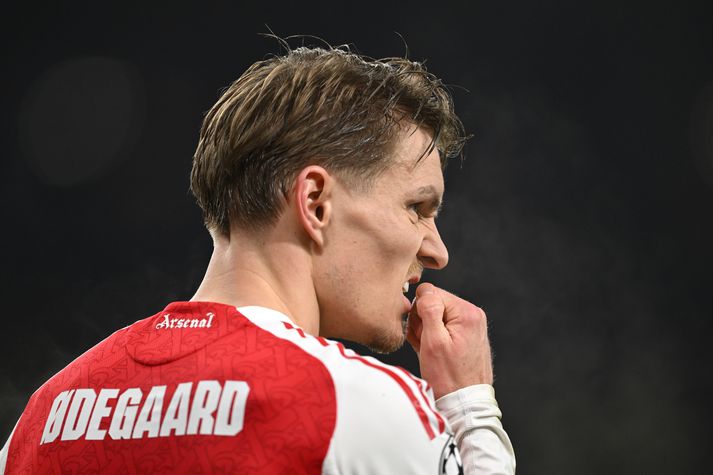 Martin Ödegaard gæti tekið þátt í úrslitaleiknum en þá þarf hann að sýna að hann sé leikfær á æfingu Arsenal á morgun.