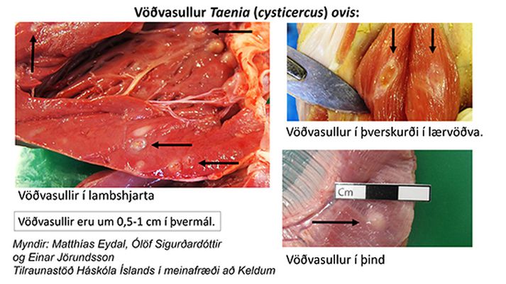 Hér má sjá einkenni vöðvasulls.