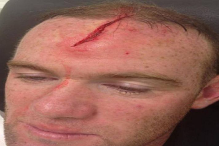 Wayne Rooney.