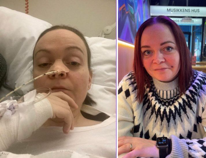 Myndin til vinstri af Herdísi er tekin í desember 2024, eftir 49 daga sjúkrahúsvist. Myndin til hægri er tekin eftir aðgerðina.