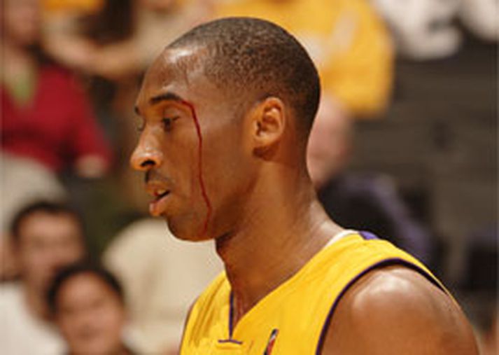 Kobe Bryant er hér vankaður á svip eftir höggið frá Mike Miller, en hann átti svo sannarlega eftir að láta finna fyrir sér þegar hann sneri til baka saumaður