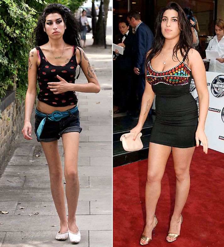 Amy Winehouse í dag, og árið 2004. Stjarnan hefur hríðhorast frá því hún kom fyrst fram á sjónarsviðið