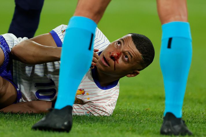 Kylian Mbappé varð fyrir því óláni að nefbrotna i fyrsta leik Frakka á EM 2024.