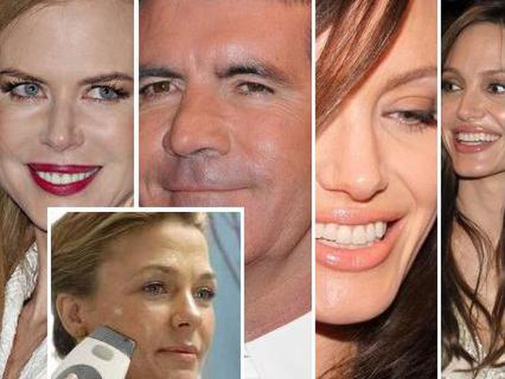 Nicole Kidman, Simon Cowell og Angelina Jolie nota hrukkustraujárnið sem er að gera allt vitlaust í Hollywood.