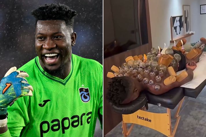 Ýktasta sogskálameðferð sögunnar? Hún virðist hjálpa André Onana.