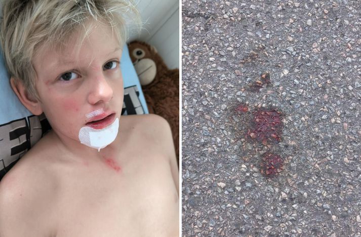 Vænn blóðblettur varð eftir á götunni þar sem drengurinn féll til jarðar.