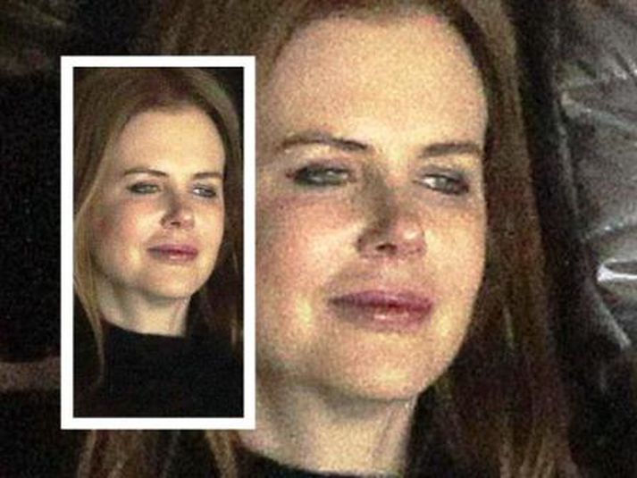Enginn að horfa? Allur heimurinn fylgist með breytingunum sem hafa orðið á þér Nicole.