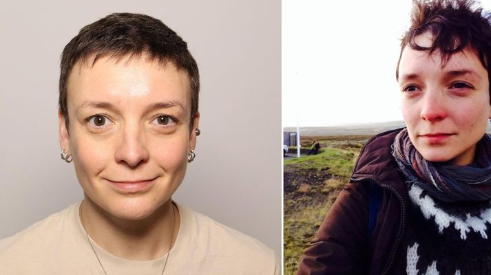 Kelsey bendir á að OCD sé langvarandi ástand sem þurfi að læra að lifa með og halda utan um.