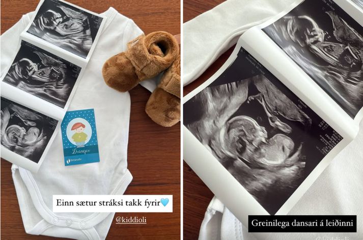 Birta greindi frá kyni barnsins á samfélagsmiðlum.