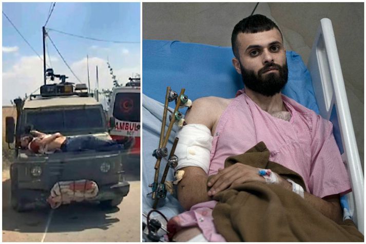 Ísraelsher hefur verið sakaður um að nota Palestínumanninn Mujahid Abadi sem skjöld, þegar hermenn festu hann framan á bíl á laugardaginn. 
