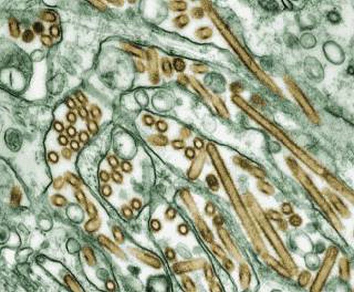 H1N1-veiran.