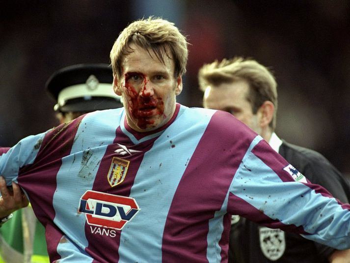 Merson eftir hasar gegn Michael Duberry í leik Leeds og Aston Villa. Hann slapp betur úr árekstrinum en slagnum gegn Duberry.