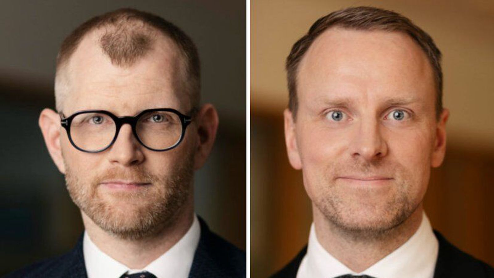 Skaðabótalög – tíma­bærar breytingar