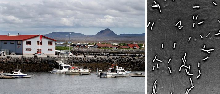Fólk getur veikst heiftarlega næli það sér í e. coli veiruna.