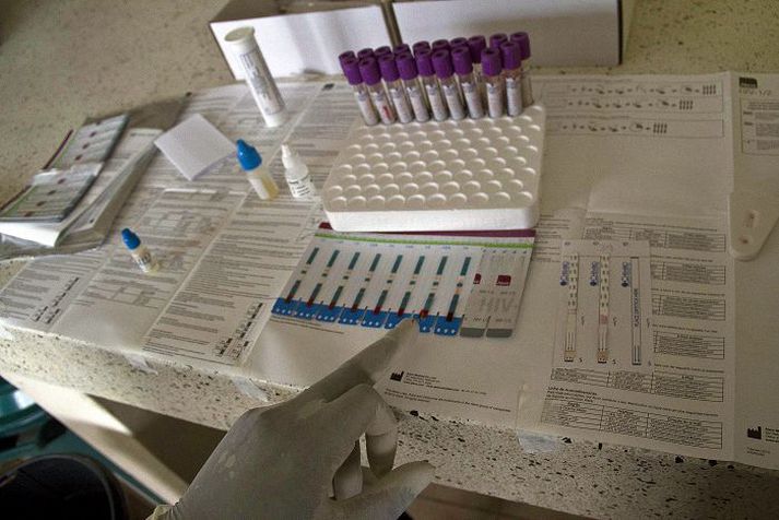 Kannað hvort HIV-veiran leynist í blóði manns í Úganda.