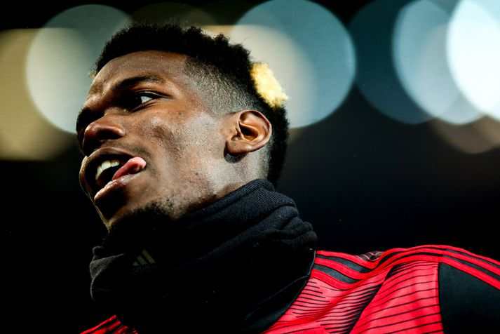 Paul Pogba þarf fjórar vikur til að ná sér góðum eftir aðgerðina.